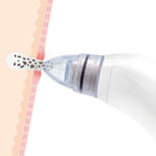 InnovaGoods Electric Mitesser-Reiniger Pore·Off – Produktansicht 2