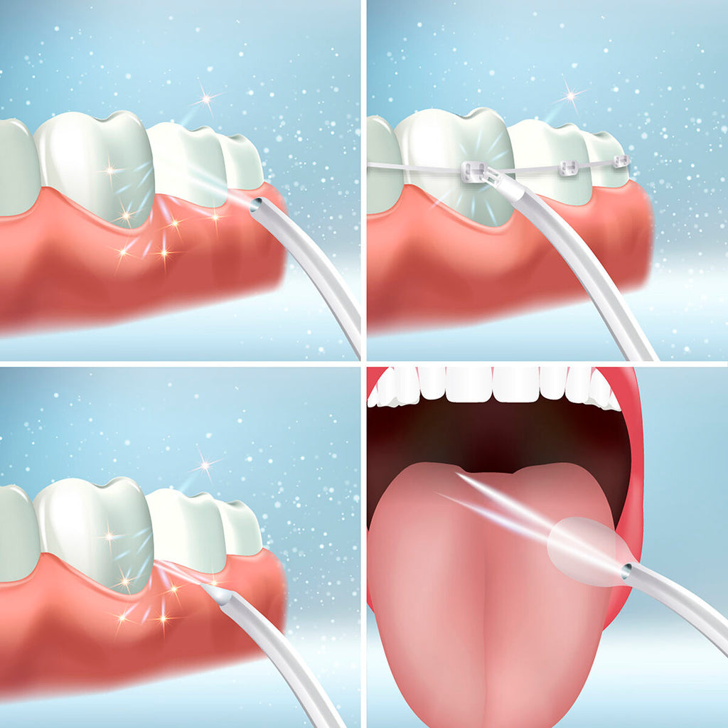 InnovaGoods Tragbar Wiederaufladbar Oral Irrigator Denter – Produktansicht 5